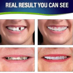 2 set tandproteser, övre och nedre tandproteser, naturliga och bekväma, skyddar dina tänder och återställer ett självsäkert leende><noscript><img width=