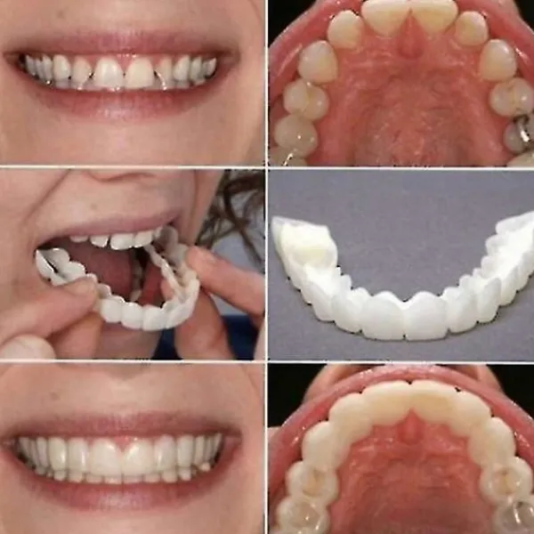 Ett par övre och nedre högkvalitativa proteser Omedelbart leende Komfort Passform Flex Kosmetiska tänder Tandprotes Tänder Topp kosmetisk faner Perfekt_max | Fyndiq> Tillbehör