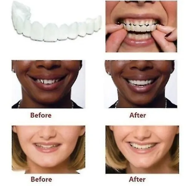 Ett par övre och nedre högkvalitativa proteser Omedelbart leende Komfort Passform Flex Kosmetiska tänder Tandprotes Tänder Topp kosmetisk faner Perfekt_max | Fyndiq> Tillbehör