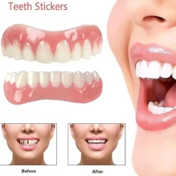 Extra tunna falska ljusa vita tandfanér i silikon, mjuka, säkra, självhäftande proteser, döljer nyanser, tandställning, bekväma tänder, ortodonti, DVM | Fyndiq> Tillbehör