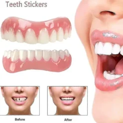 Extra Tunna Falska Ljusa Vita Tandfasader Silikon Mjukt Säkert Självhäftande Tandprotes Dölj Nyans Hängslen Bekväma Tänder Ortodontisk - xin> Tillbehör