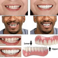 Extra Tunna Falska Ljusa Vita Tandfasader Silikon Mjukt Säkert Självhäftande Tandprotes Dölj Nyans Hängslen Bekväma Tänder Ortodontisk - xin><noscript><img width=