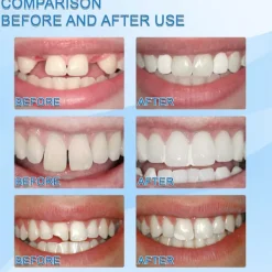 ATELA Jaysuing formbar tandgel Film- och tv-smink Tandprotesfixering Tillfällig fyllning Trasig tand Gapfyllning><noscript><img width=