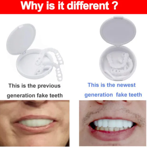 Löstander, övre och nedre proteser, Snap On V SQBB_max> Tillbehör