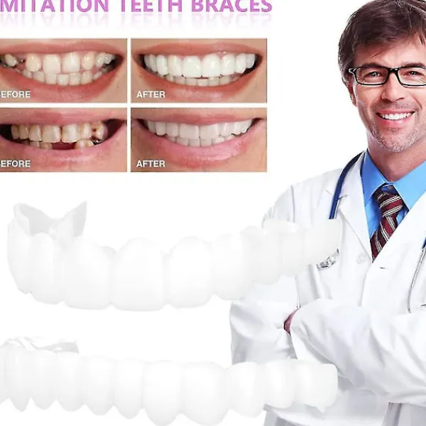 Snap On Tandfanér, Perfekta Tillfälliga Tandersättningar - Falska Fanérkit> Tillbehör