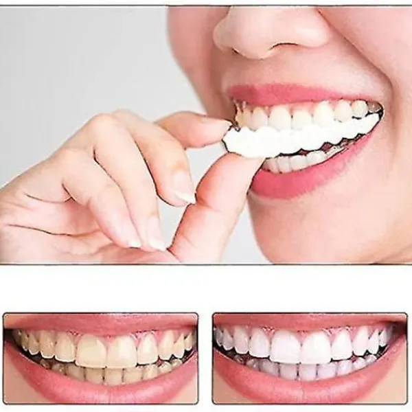 Snap On Tandfanér, Perfekta Tillfälliga Tandersättningar - Falska Fanérkit> Tillbehör