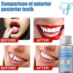 Superstark Formbar Tandlim Superstark Naturharts Tandproteslim Tillfällig Makeup Reparation Trasiga Mellanrum Falska Tänder Fixerat Lim 20g><noscript><img width=