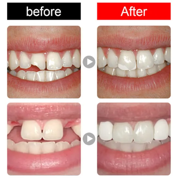 Tandfyllningssats Tillfällig Tandlim för Trasiga Tänder, Att Forma Hålen I Tanden, Halloween Smink Tandmodifiering> Smink