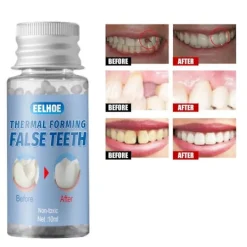 LAIQIANKUA Tillfälligt kosmetiska löständer saknade tandfyllmedel 20g> Tillbehör