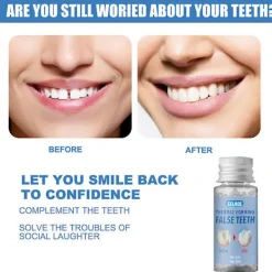 LAIQIANKUA Tillfälligt kosmetiska löständer saknade tandfyllmedel 20g><noscript><img width=